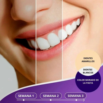 Blanqueador Dental Hismile